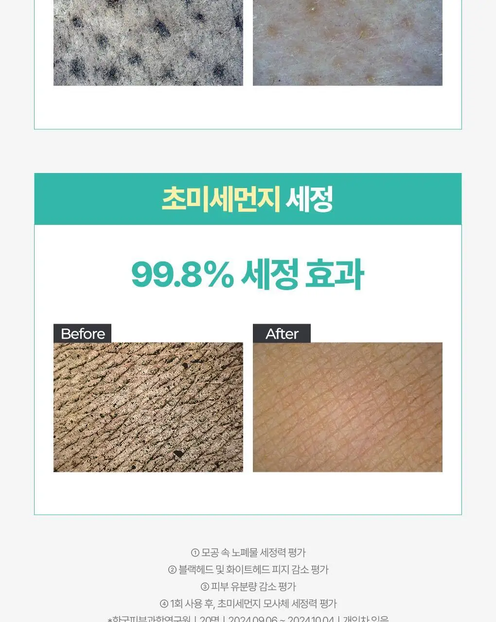 [고밀도효소거품] 브링그린 티트리 시카 딥클렌징폼 기획 (단품/ 더블/ 대용량) 상세페이지 20